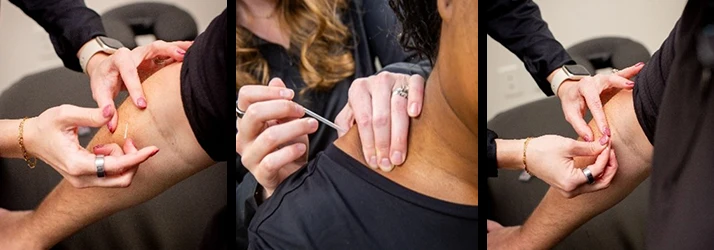 Dry Needling Collage Depicting Patient Experience